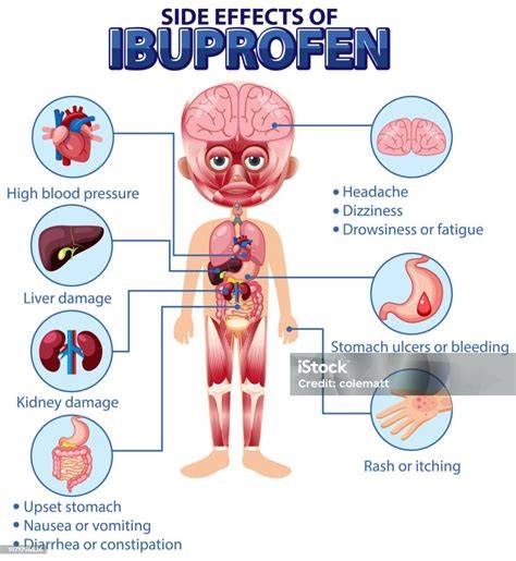 Efek Samping Ibuprofen