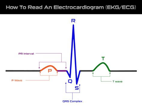 Elektrokardiogram (EKG)