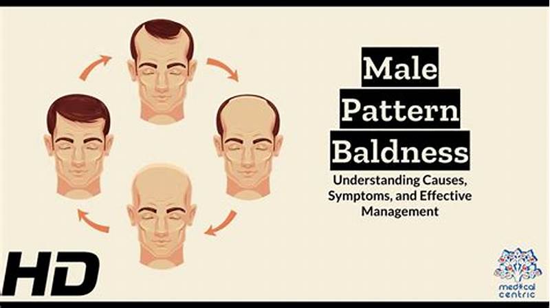 Expression Of Pattern Baldness In Humans