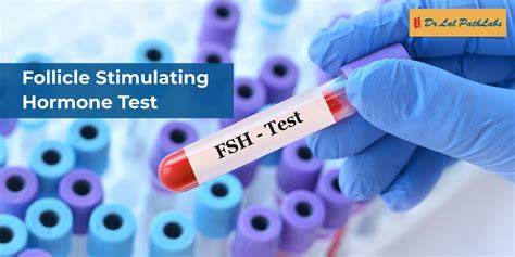 FSH blood test