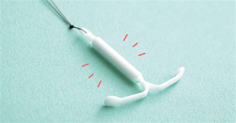 Fakta Menarik IUD