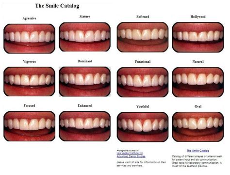 False Teeth Colour Chart