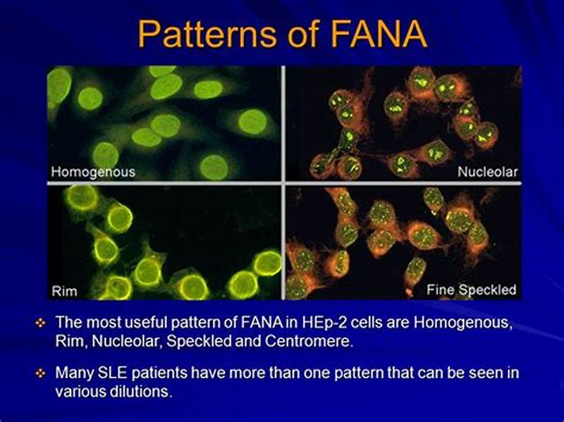 Fana Staining Patterns Homogeneous Pattern High