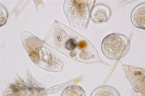 Fitoplankton microscopic view