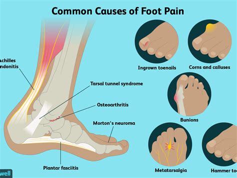 Pain Anatomy