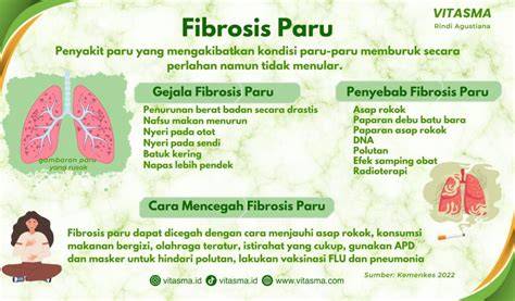 Gejala Fibrosis Paru