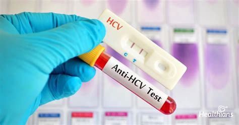 HCV Antibody Test