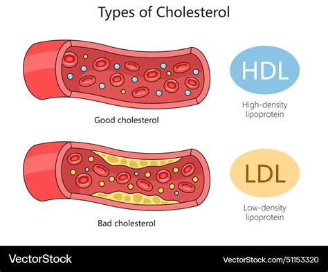 HDL vs LDL diagram
