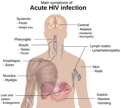 HIV and the immune system