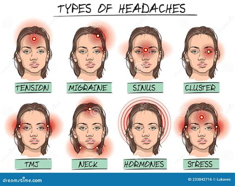 Head Pain Chart