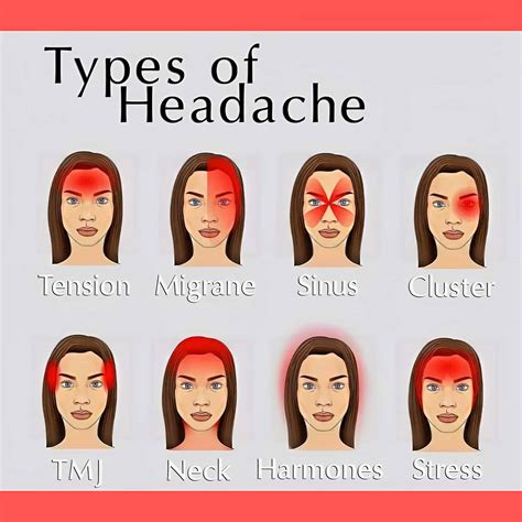 Headache Chart And Meaning