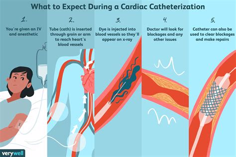 Heart Catheterization