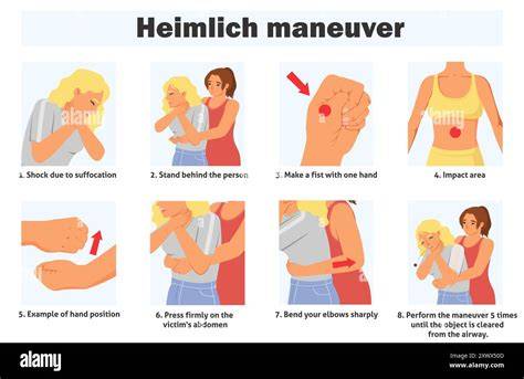 Heimlich Maneuver
