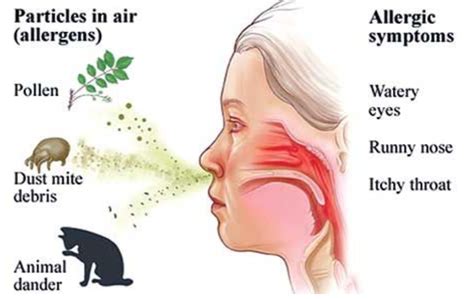 Hidung Gatal