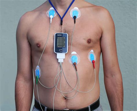 Holter Monitor