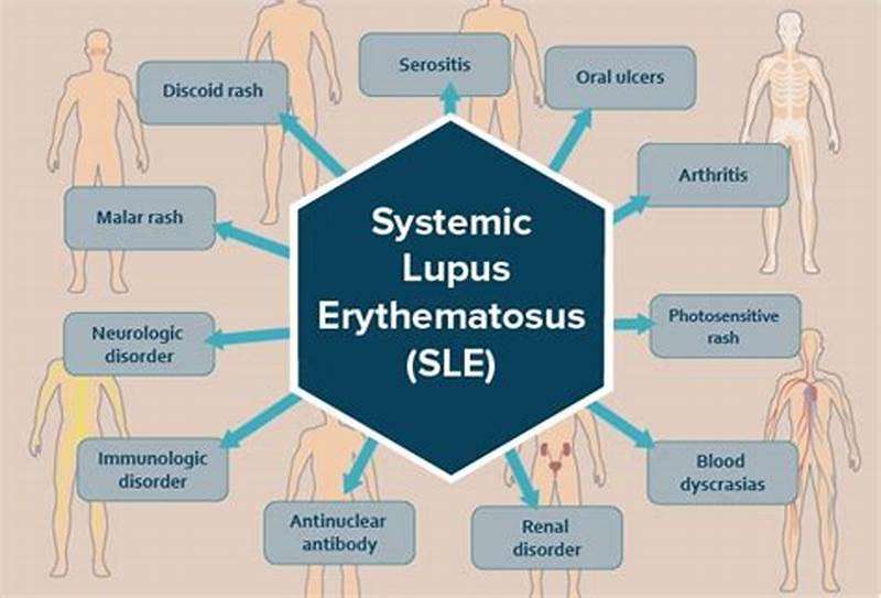 Homogeneous Pattern Is Associated With Systemic Lupus