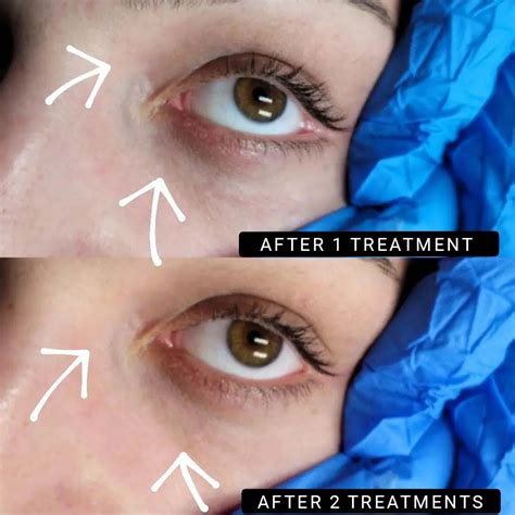 How Much Does Permanent concealer cost