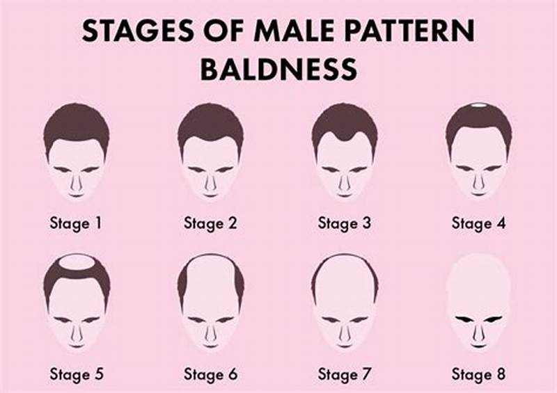 How To Check For Male Pattern Baldness