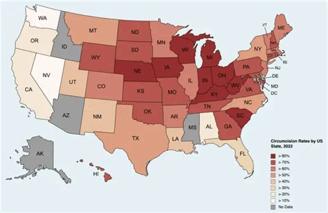 How common is circumcision in the US 2020