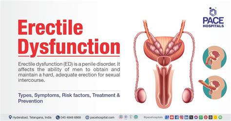 How do you know if a man has erectile dysfunction