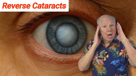 How do you reverse cataracts naturally