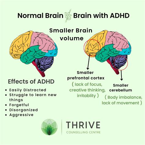 How does ADHD show in the brain