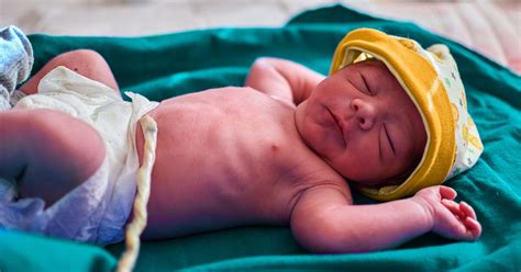 How long does it take for the umbilical cord to heal after it falls off