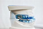 How to Care for a Dental Appliance