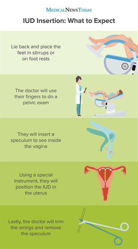 IUD insertion process
