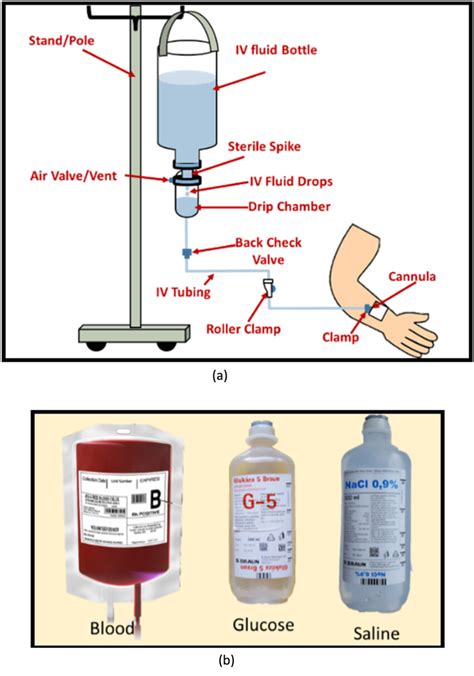 IV fluid infusion