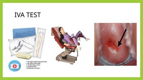 IVA test procedure illustration