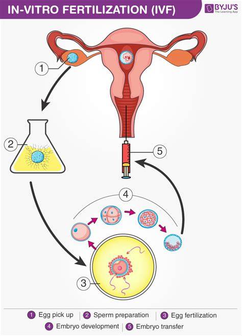 Apa itu IVF