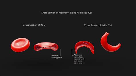 In-cell vs On-cell vs Out-cell