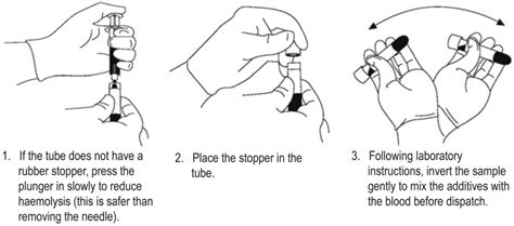 Infected Blood Draw Site