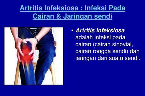 Infeksi Sendi