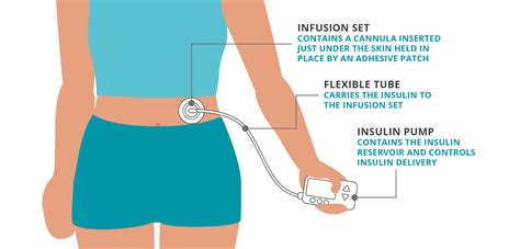 Insulin