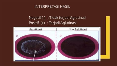 Interpretasi Positif SJW