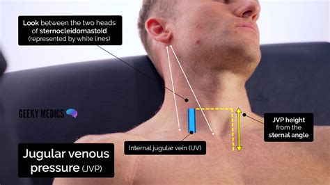 JVP assessment neck