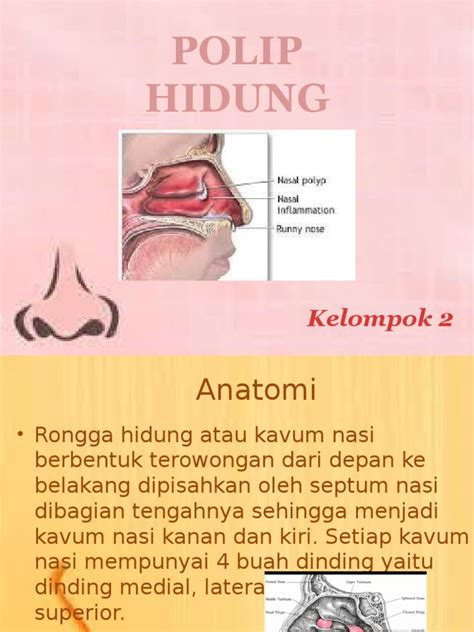 Jenis-Jenis Polip