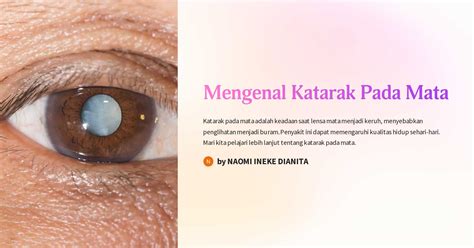 Katarak