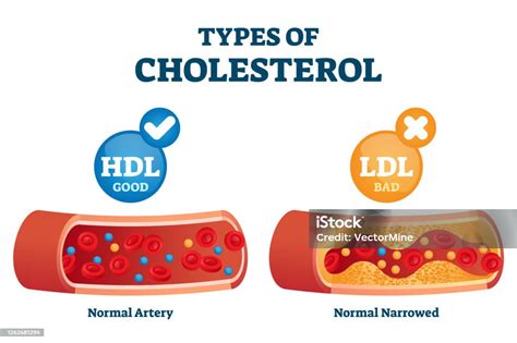 Kolesterol HDL dan LDL
