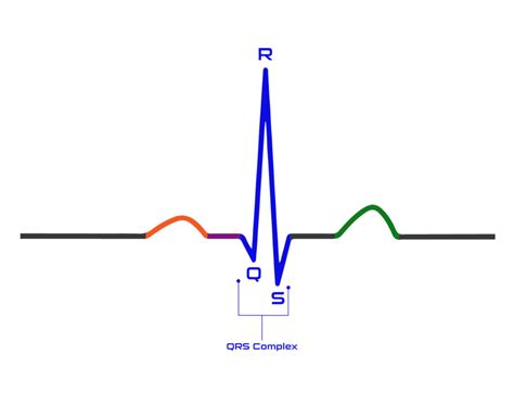 Kompleks QRS