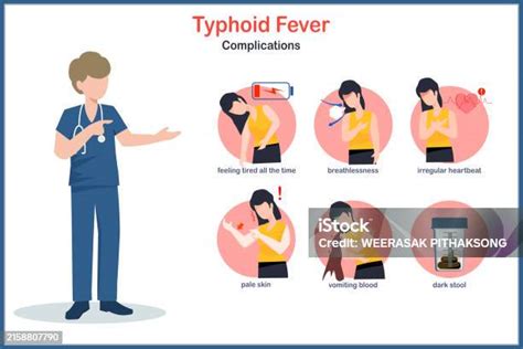 Komplikasi Typhoid Fever yang Serius