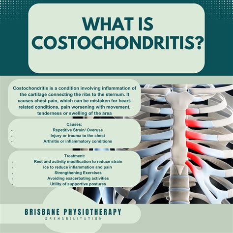 Kostokondritis