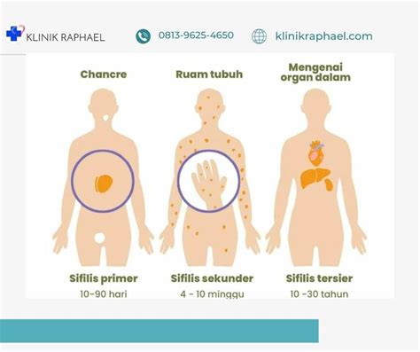 Luka Sifilis Primer