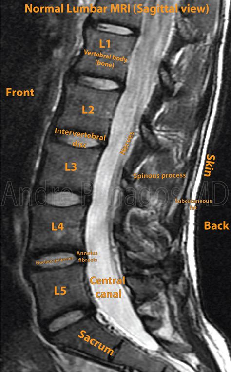 Lower Lumbar Spine