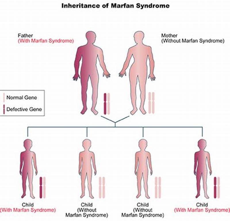 Marfan Inheritance Pattern