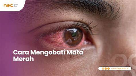 Mata Merah