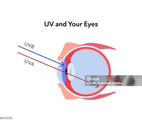 Mata kena UV