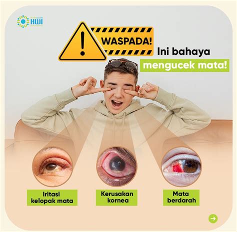 Mengucek Mata